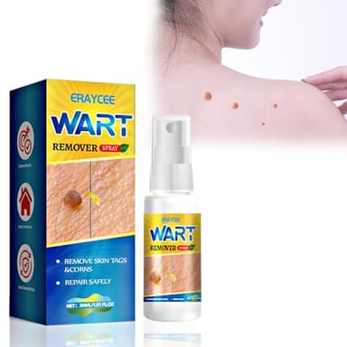 Verruca and Wart Remover - 30ml, Verucca Freeze Treatment for Effective Wart and Verucca Removal, Skin Tag Removal Spray (30ML)